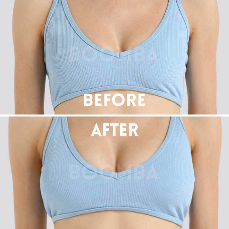 Invisible Lift Before After Close Up